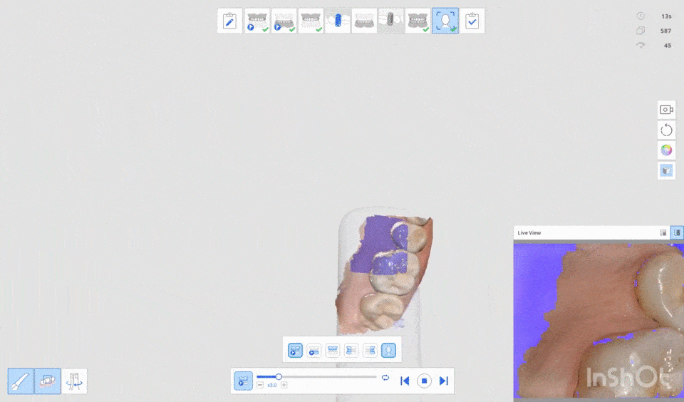3D digital dentistry CAD/CAM animation - Mineers Smile Center Beirut