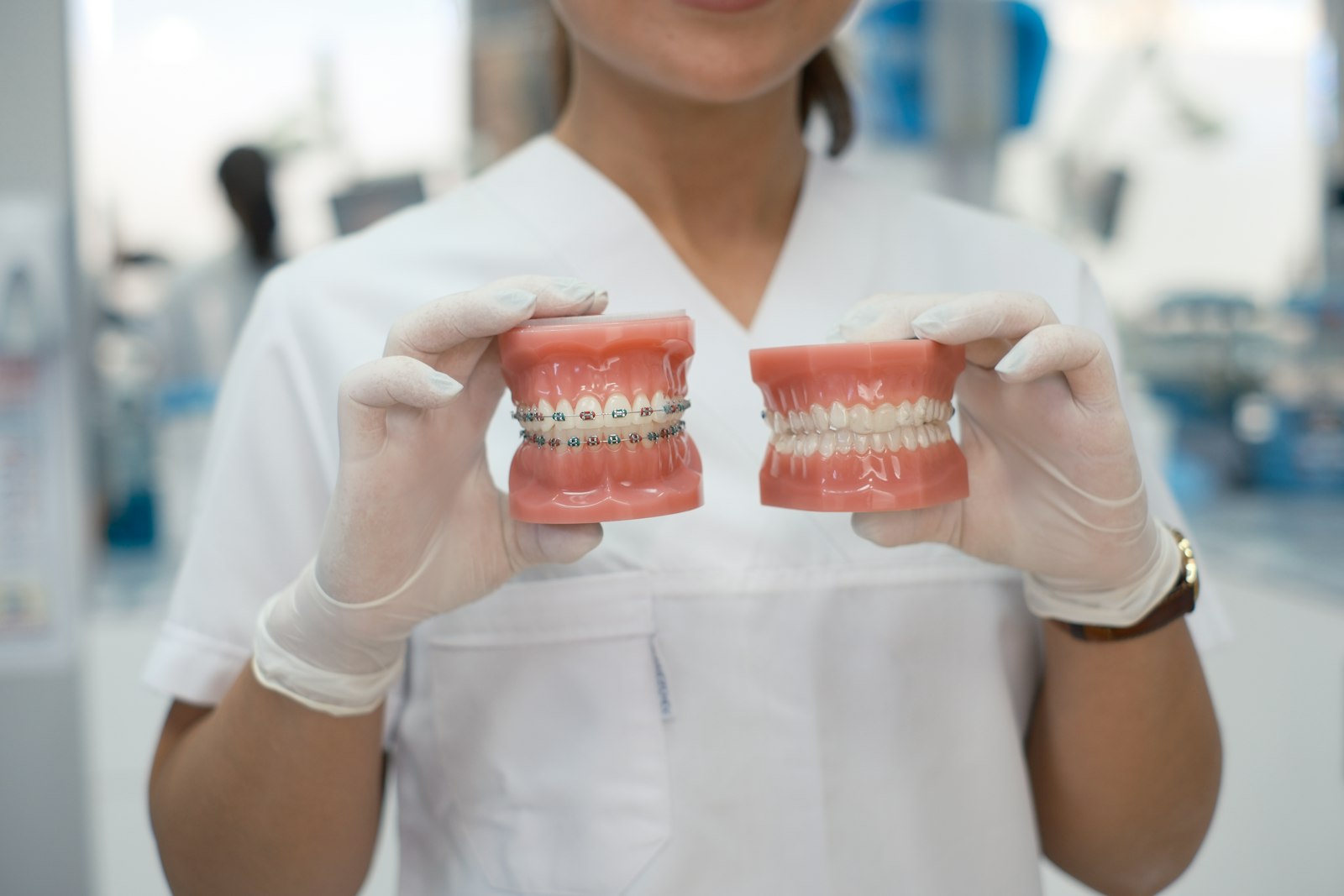 Dental Crown vs Veneer: Key Differences and How to Choose